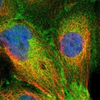 Immunofluorescent staining of human cell line A-431 shows localization to plasma membrane & cytosol.