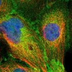 Immunofluorescent staining of human cell line A-431 shows localization to plasma membrane & cytosol.