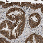 Anti-ADGRL3 Antibody