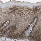 Immunohistochemical staining of human cervix, uterine shows moderate to strong membranous and cytoplasmic positivity in squamous epithelial cells.