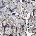 Immunohistochemical staining of human placenta shows moderate membranous positivity in trophoblastic cells.