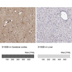 Anti-S100B Antibody