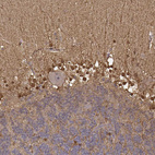 Immunohistochemical staining of human cerebellum shows moderate to strong nuclear and cytoplasmic positivity in glial cells.
