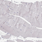 Anti-S100B Antibody