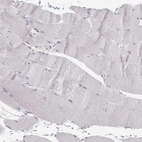 Immunohistochemical staining of human skeletal muscle shows no positivity in myocytes as expected.