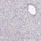 Immunohistochemical staining of human liver shows no positivity in hepatocytes as expected.