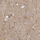 Immunohistochemical staining of human cerebral cortex shows moderate to strong cytoplasmic and nuclear positivity in glial cells.