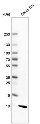 Western blot analysis in human cerebral cortex tissue.