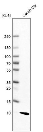 Western blot analysis in human cerebral cortex tissue.