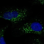 Immunofluorescent staining of human cell line U-2 OS shows localization to vesicles.