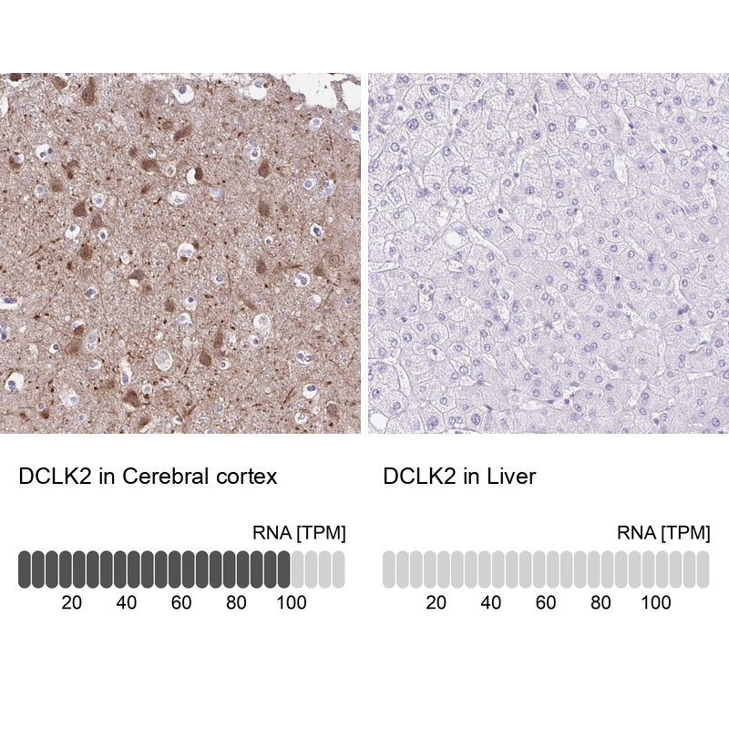 Anti-DCLK2 Antibody