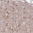 Immunohistochemical staining of human cerebral cortex shows strong cytoplasmic positivity in neurons.