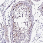 Immunohistochemical staining of human testis shows moderate cytoplasmic positivity in spermatogonia.