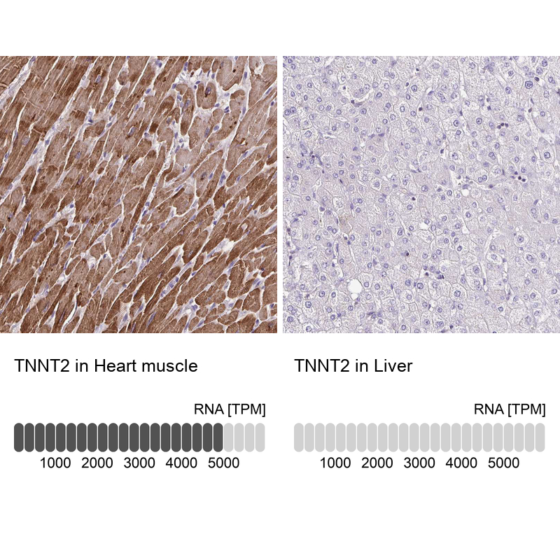 Anti-TNNT2 Antibody
