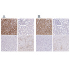 Immunohistochemical staining of human heart muscle, kidney, liver and skeletal muscle using Anti-TNNT2 antibody HPA015774 (A) shows similar protein distribution across tissues to independent antibody HPA017888 (B).