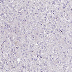 Immunohistochemical staining of human liver shows no positivity in hepatocytes as expected.