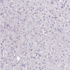 Immunohistochemical staining of human liver shows no positivity in hepatocytes as expected.