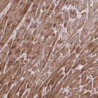 Immunohistochemical staining of human heart muscle shows strong cytoplasmic positivity in cardiomyocytes.