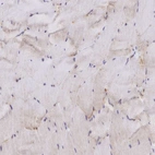 Immunohistochemical staining of human skeletal muscle shows very weak positivity in myocytes.