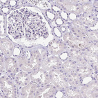 Immunohistochemical staining of human kidney shows no positivity in cells in tubules as expected.