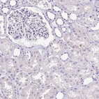 Immunohistochemical staining of human kidney shows no positivity in cells in tubules as expected.