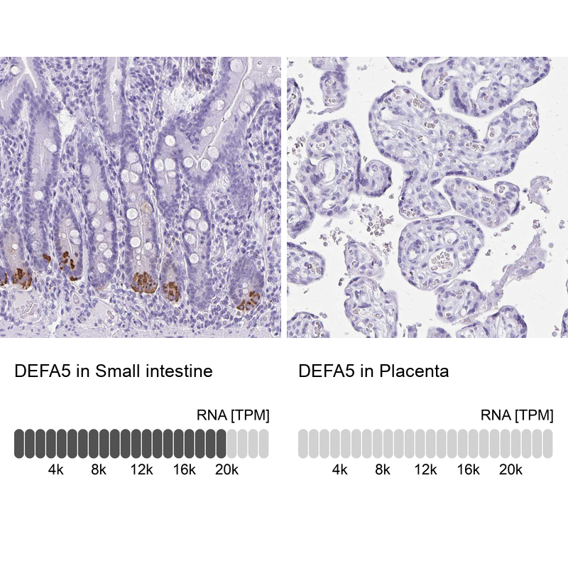 Anti-DEFA5 Antibody