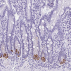 Immunohistochemical staining of human small intestine shows strong cytoplasmic positivity in Paneth cells.