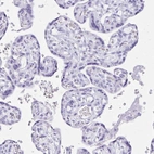 Immunohistochemical staining of human placenta shows no positivity in trophoblastic cells as expected.