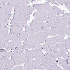 Immunohistochemical staining of human skeletal muscle shows no positivity in myocytes as expected.