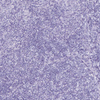 Immunohistochemical staining of human tonsil shows no positivity in non-germinal center cells as expected.