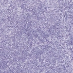 Immunohistochemical staining of human tonsil shows no positivity in non-germinal center cells as expected.