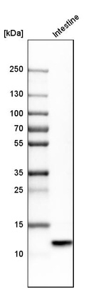 Western blot analysis in human small intestine tissue.