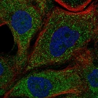 Immunofluorescent staining of human cell line EFO-21 shows localization to cytosol.
