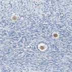 Anti-SALL4 Antibody