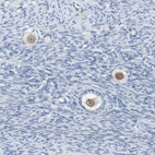Immunohistochemical staining of human ovary shows weak nuclear positivity in follicle cells.