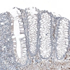 Immunohistochemical staining of human colon shows no positivity in glandular cells as expected.