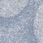 Immunohistochemical staining of human lymph node shows no positivity in germinal center cells as expected.