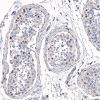 Anti-SALL4 Antibody