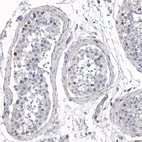 Immunohistochemical staining of human testis shows weak to moderate nuclear positivity in a subset of cells in seminiferous ducts.