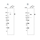 Western blot analysis using Anti-SALL4 antibody HPA015791 (A) shows similar pattern to independent antibody HPA015291 (B).