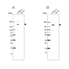 Western blot analysis using Anti-SALL4 antibody HPA015791 (A) shows similar pattern to independent antibody HPA015291 (B).