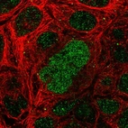 Immunofluorescent staining of human cell line CACO-2 shows localization to nucleoplasm.