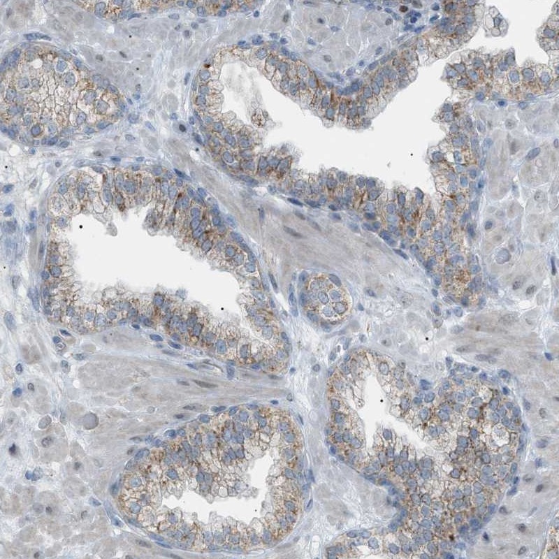 Anti-ZNF516 Antibody