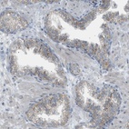 Anti-ZNF516 Antibody