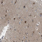 Anti-PKD2 Antibody