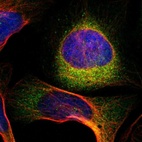 Immunofluorescent staining of human cell line U-2 OS shows localization to cytosol.
