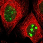Immunofluorescent staining of human cell line A-431 shows localization to nucleus & nucleoli.