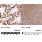 Anti-NSD2 Antibody