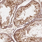 Immunohistochemical staining of human testis shows high expression.