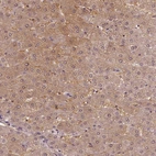 Immunohistochemical staining of human liver shows low expression as expected.